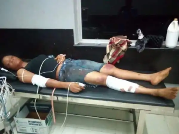 Lady Attacked & Robbed By One Chance Robbers In Abuja. Policeman Collects Bribe (Photos)